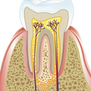 root canal in eugene 