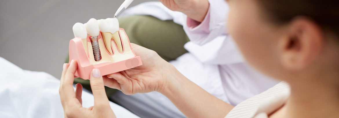 Understanding the Value of Dental Implants